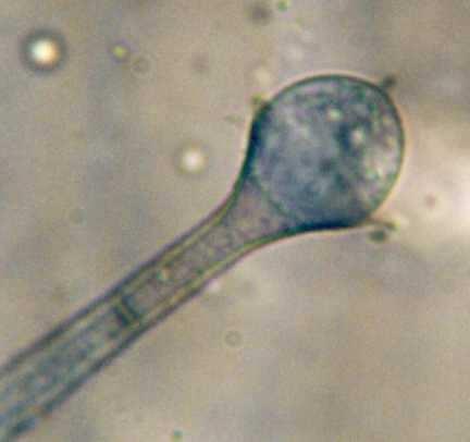 2. Nepohlavní rozmnožování 1. Sporangia kolumelátní (př. Mucor sp.)(obovoidní, obpyriformní) vs. nekolumelátní a/ apofýzy - apofyzátní sporangia (Absidia sp.