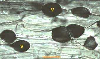 Řád: Glomales (odd: Glomeromycota) rody: Acaulospora,