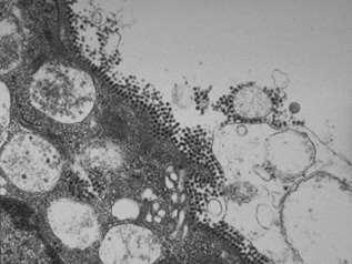Izolace virů z klinických vzorků může trvat několik týdnů až měsíců Cytologie moči - Přítomnost buněk se zvětšeným jádrem s jednou velkou bazofilní intranukleární inkluzních (decoy cells).