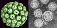 Metody detekce HPyV - serologie Serologie Využití rekombinantně exprimovaného virového proteinu VP1 (virus like particles VLP) nebo části T-antigenu.