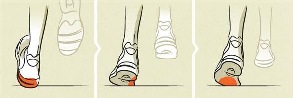 lze řešit správným výběrem obuvi, ale při došlapu s nedostatečnou pronací (supinace) jako právě na obrázku 10, je zapotřebí využívat i speciálních ortopedických pomůcek (na míru