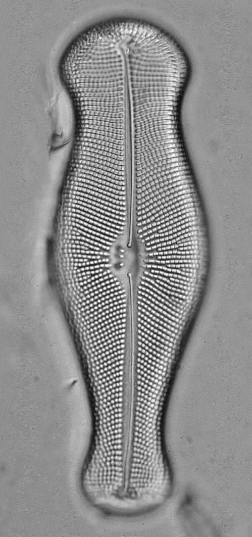 Didymosphenia geminata (trvalý preparát ) striae