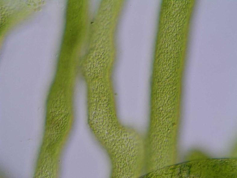 oogonium sifonální vlákna s drobnými chloroplasty Výskyt: stojaté sladké
