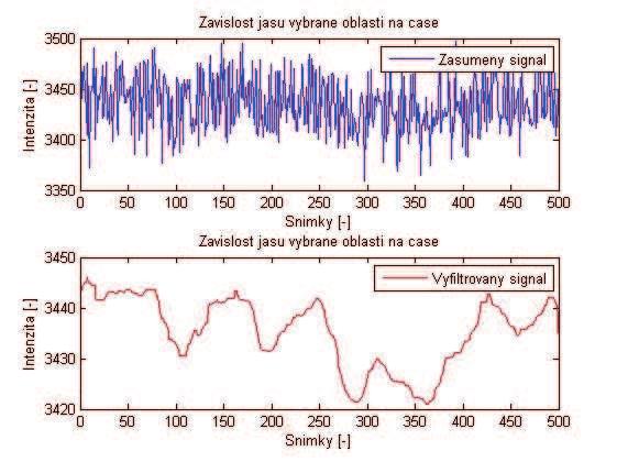 Výsledná filtrace pomocí filtru smooth a mediánu vykazuje skokové změny, které by mohly odpovídat vysílaným stimulačním impulzům. Tento předpoklad bude potvrzen nebo vyvrácen v navazující kapitole.