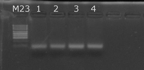 VÝSLEDKY A DISKUZE Při použití metody AS PCR a dvou párů primerů nebyly nikdy získány PCR produkty. Nedošlo k nasednutí primerů a k namnožení ohraničeného vymezeného fragmentu DNA (Obr. 1).