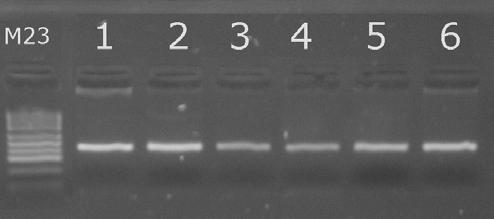 1 Vizualizace PCR produktů (AS PCR) Negativní amplifikace může být zapříčiněna nesprávně zvolenou konfigurací primerů, kde poměr G/C neodpovídá optimálním 50%, ale je mnohem menší (Tab. 1).