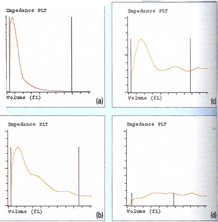 Impedanční histogram normál Impedanční histogramy PLT