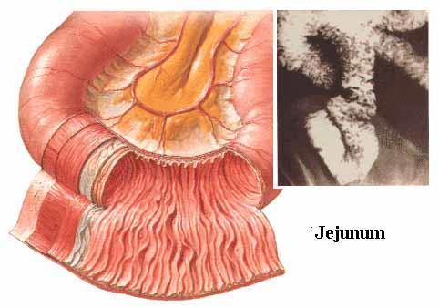 Jejunum Rozdíl Ileum tmavě červené barva světle růžové větší (2 4 cm) průsvit menší (2 3 cm)