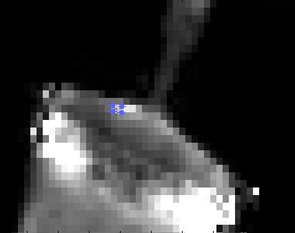 10.2.2 sekvence FLASH 3D, metoda multiple FA, volba AIF č.1b Jako AIF byla zvolena oblast méně světlých pixelů viz obrázek č. 33. Obr. č. 31: Výřez obrazu sekvence FLASH, detail výběru AIF Výběr TRF byl stejný jako v předchozím případě.