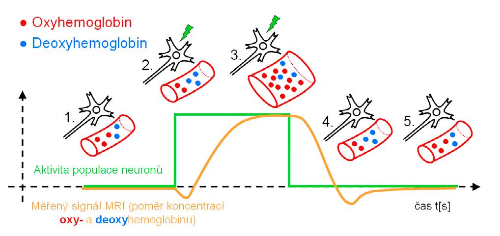 LISTY KLINICKÉ LOGOPEDIE 2/2018 23 hemoglobin přiváděný z plic tepnami do tkání (oxyhemoglobin) je diamagnetický a nepůsobí ve svém okolí změnu magnetického pole.