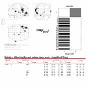 v klidu ve zšeřelé místnosti REST - Random Episodic Silent Thinking (Andreasen et al.,1995).