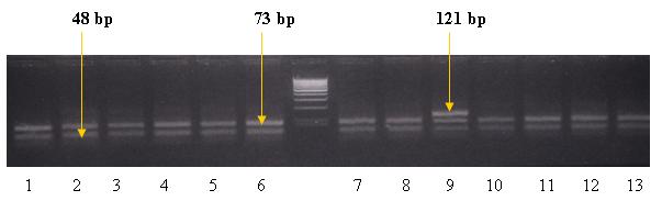 Příloha 4: Polymorfizmus délky restrikčních fragmentů tyrosinase-related protein 1 genu (TYRP1)