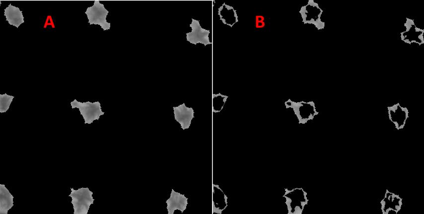 Obrázek 4: Detekce mechu a protonema Poslední krokem analýzy je vypočítání plochy [4], která je pokrytá mechem.