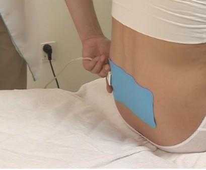 RF ošetření Přiložení katodové destičky na tělo