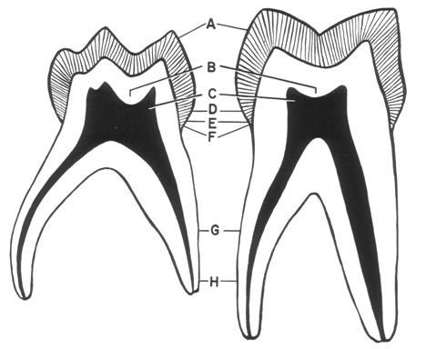 Rozdíly ve stavbě ve stálé a dočasné dentici Kořen a KK u dočasných zubů jsou vyvinuty krátké kořenové kanálky a samotný kořen je kratší, užší a tvarovaný do oblouku; ustupuje tak zubu stálému, který
