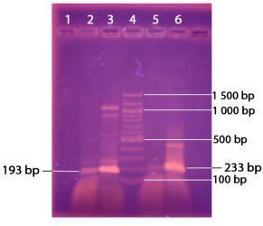 Obr. 3: Agarosová gelová elektroforéza produktů PCR. Amplifikována byla DNA L. fermentum (100 ng/µl) s primerem F357a R518 (193 bp) (běhy č. 2 a 3) a F357GC a R518 (233 bp) (běhy č. 5 a 6).