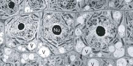 Vakuola 39 Tekutinou naplněné kompartmenty pokryté tonoplastem; 30-90% objemu buňky Dospělé buňky velké vakuoly Mladé buňky (např.