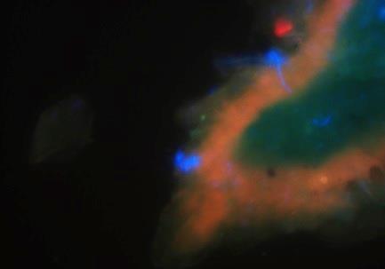 fluorescenčním barvivem. 5.