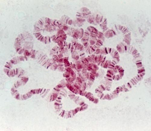 Chromozom - struktura Chromatin / Chromatinové vlákno Heterochromatin