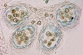 obdobích fenomén kalosy Kalosa β-1,3-glukan Syntéza: β-1,3-glukan synthasa (kalosa synthasa) Degradace: