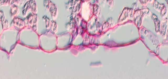 houbovitý parenchym 1 svrchní epidermis, 2 palisádový