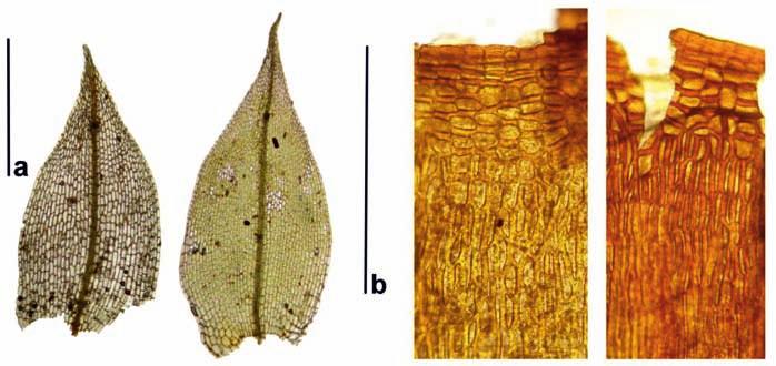 Listy (a, měřítko = 875 µm) a horní buňky exothecia tobolky (b, měřítko = 400 µm). Foto S.