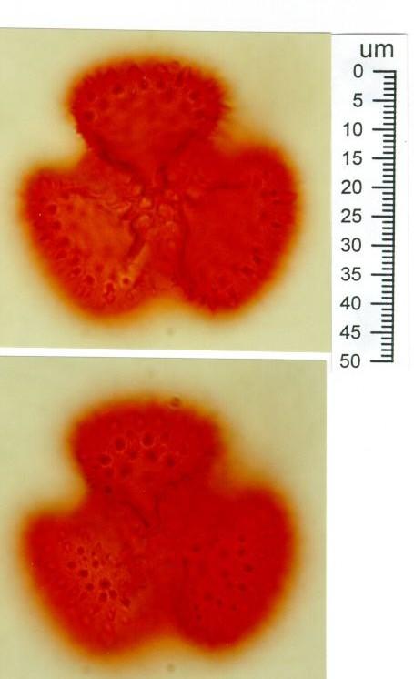 Drosera semena 1,5 x 0,5 mm, 0,000 02 g embryo malé, endosperm k němu přitisknutý