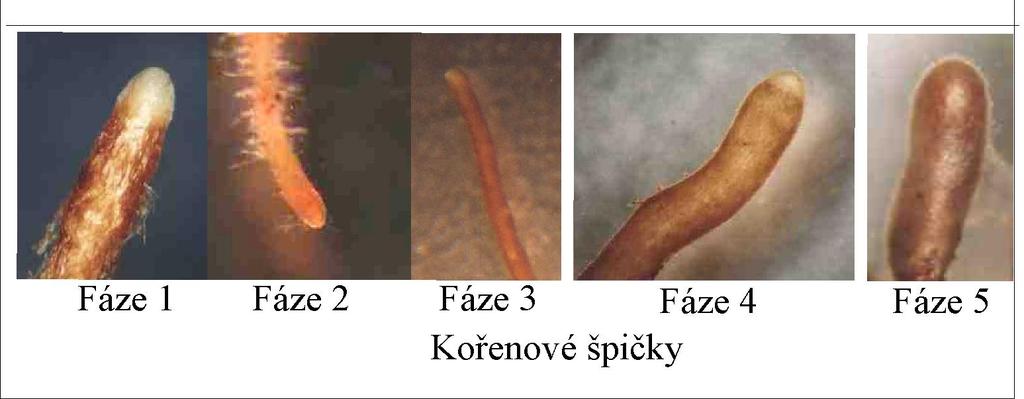 Zjišťování fází vývoje a tříd vitality ektomykorhiz (Cudlín, Chmelíková 1999) fáze 1 - špička s aktivním meristémem fáze 2 -