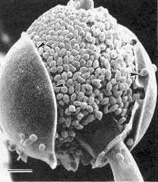 Zygomycetes sporangium s velkým počtem sporangiospor sporangiospory