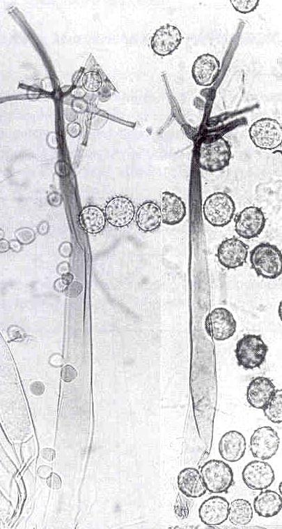 kolumely ve sporangiu a zygosporangia některých druhů