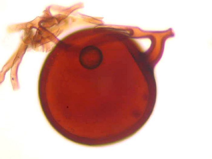 Arbuskulární endomykorhiza. Kolem 80% všech známých endomykorhiz.
