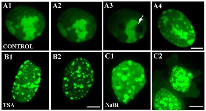 HP1 proteins HP1 proteiny jsou hlavní složkou heterochromatinu a hrají důležitou úlohu při jeho tvorbě.