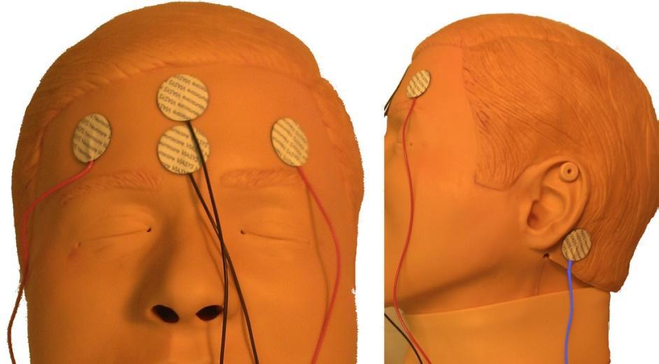 Diagnostika NCS-E Pouze a výhradně EEG!