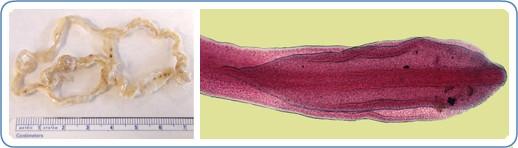 Diphyllobothrium latum a příbuzné druhy tasemnic patří mezi největší napadající člověka (přes 10m).