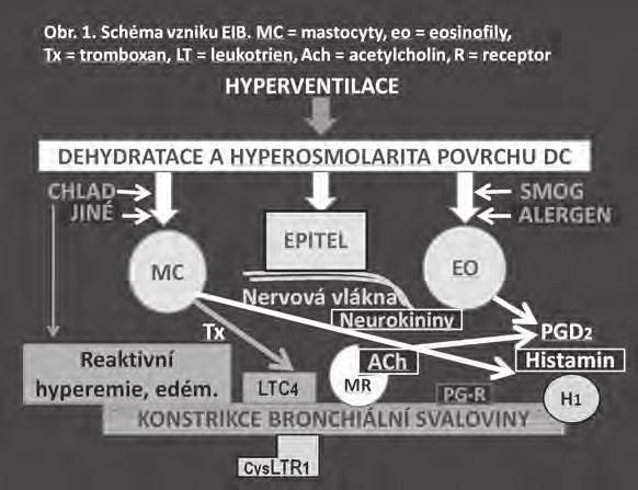 Algorytmus vyšetření EIB (obr. 2).