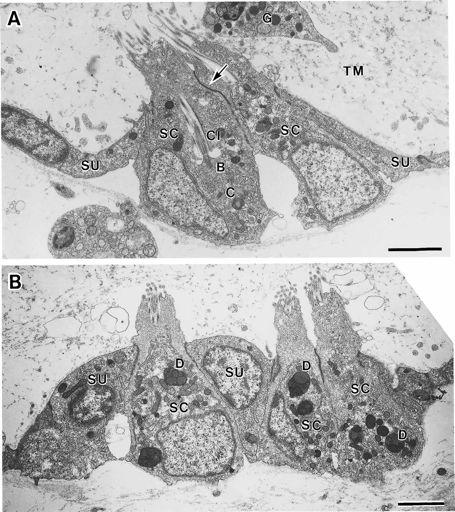 ní p'ed%l viscerálního ganglia a mozku dtto Craniata Cra Cep Tun Cep Tun Cra Cra Tun Cep * Vakovité srdce *Expanse a apomorfní diferenciace ektodermu, potla"ení metamerie * CNS: mozkové gangl.