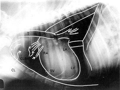 Rentgenogram hrudníku Posouzení Silueta srdce Vaskulatura plic Velké cévy Plíce Pleurální