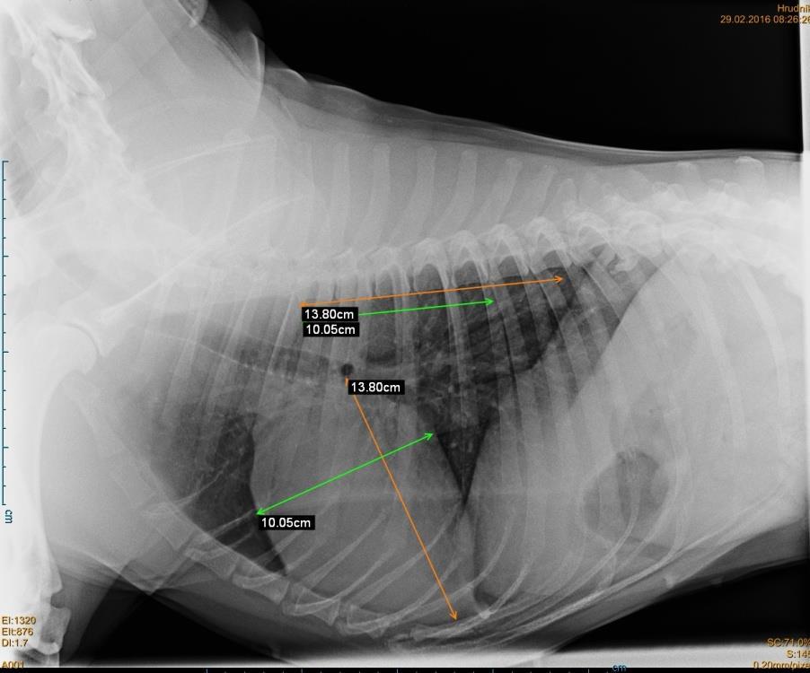 Systém rozměru obratlů Vertebral scale system - VSS Laterolaterální