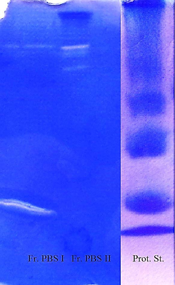 Mr 72 500 58 000 43 500 29 000 14 500 Obrázek 18 - Výsledky zymografie v redukujícím prostředí se vzorky z ionexové chromatografie.