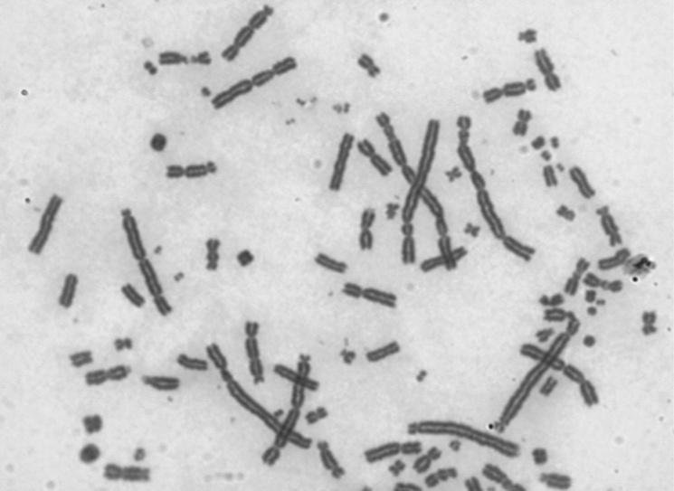 ZÍSKANÉ CHROMOSOMOVÉ ABERACE (vliv mutagenních faktorů prostředí) vlivem mutagenních faktorů prostředí dochází na chromosomech ke změnám (zlomy, vznik di-, tricentrických chromosomů, ring chromosomů