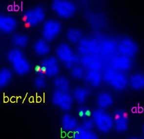 VYŠETŘENÍ CHROMOSOMŮ vyšetření v laboratořích klasické a molekulární cytogenetiky klasická cytogenetika kultivace, zpracování vstupních materiálů založeny na obdobných principech - G-pruhování