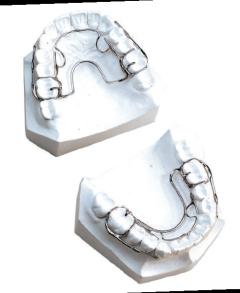 zelená oranžová stříbrná červená POP šrouby Flexibilita šroubu umožňuje úpravu případného posunu zubů v důsledku nepravidelného používání aparátku ze strany pacienta.