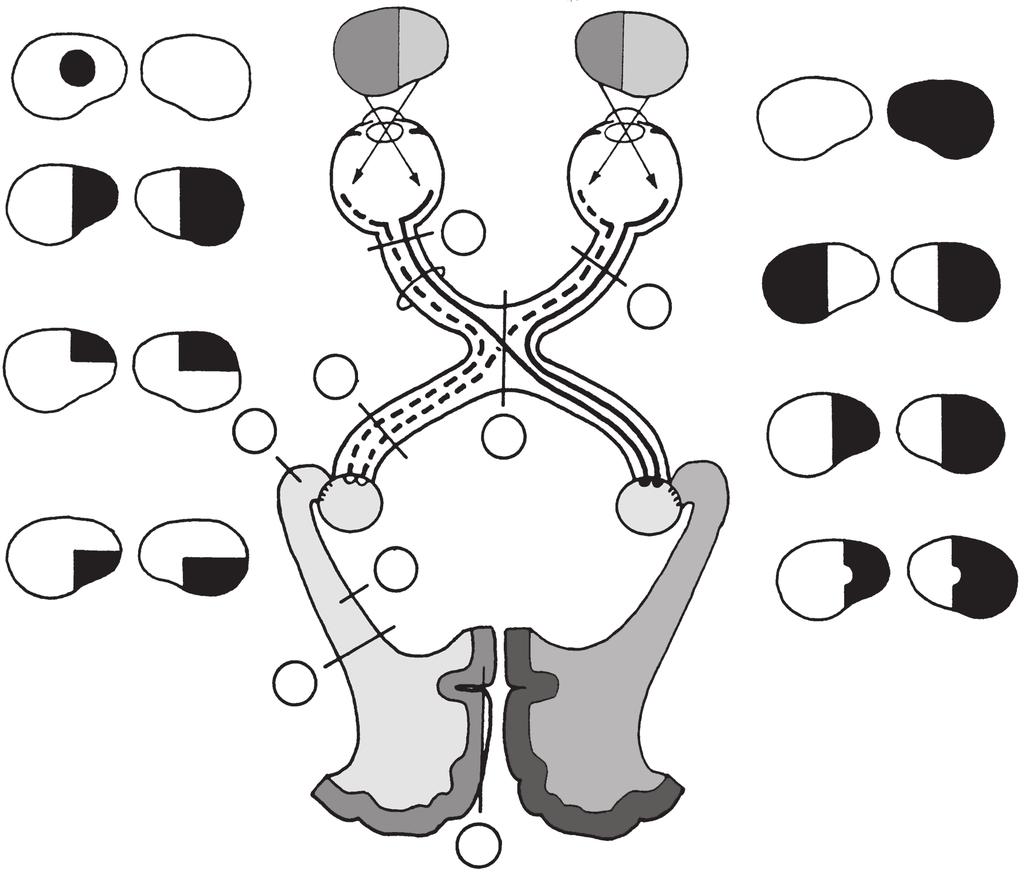 46 Základy neurologie zorné pole vlevo vpravo L P temporálně nazálně nazálně temporálně L P 1 retina 2 4 1 n.