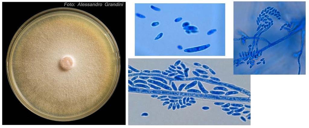 2.2.1. Fusarium oxysporum Celosvětově rozšířený fytopatogenní druh, často se vyskytuje také jako saprotrof v půdě. Mycelium na PDA (obr. 1a) je flokózní, bílé, fialovorůžové až fialové.