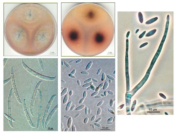 2.2.2. Fusarium solani Na PDA vytváří rychle rostoucí flokozní mycelium šedobílé barvy (obr. 2a), spodní strana často zelenavá, modrozelená či hnědá (obr. 2b). Vytváří dvojí typ konidií.