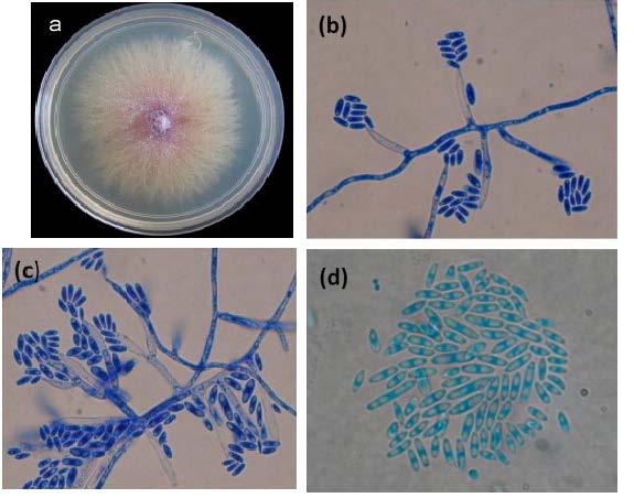 2.2.3. Fusarium subglutinans Mycelium je na PDA bělavé až šedofialové (obr. 3a). Pigmentace v agaru velmi proměnlivá, šedooranžová, šedofialová, případně až černá.