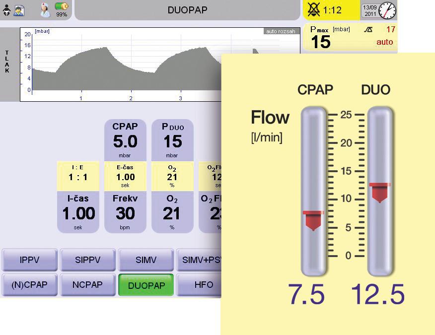 Infant Flow ncpap a DuoPAP Neinvazivní ventilační režim nabízející nasální CPAP a DuoPAP s originálními Infant Flow Inspire nasálními aplikátory a maskami Acutronic pozvedl systém Infant Flow na