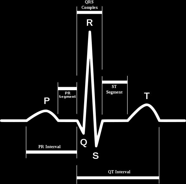 2. EKG signál 2.1. Popis EKG Jak je možno vidět na obrázku 2-1, je EKG signál složen z několika vln, intervalů a segmentů znázorňujících různé fáze srdečního cyklu.