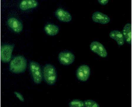 fluorescenčního obrazu můžeme usuzovat na přítomnost protilátek proti konkrétním antigenům