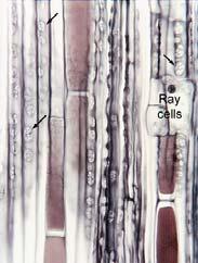 here, they are virtually impossible to identify in transverse section Xs Mauseth: web Deuterofloém Homogenní - sítkové buňky (1 sezóna) I parenchym a